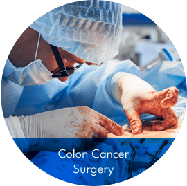 Colon Cancer Surgery