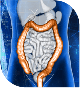 Colon and Rectal Surgery in Broward County, Florida, serving Fort Lauderdale, FL; Pompano Beach, FL; Deerfield Beach, FL; Wilton Manor, FL; Oakland Park, FL; Coral Springs, FL; Margate, FL; Plantation, FL, Davie, FL and Coconut Creek FL