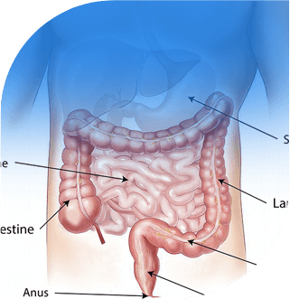 body structure fistula rectal surgery