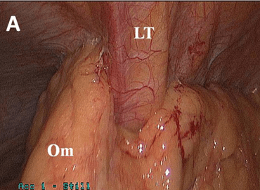 Dr Astha Bhatt MD Research Surgeon