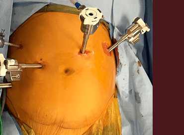 Dr Astha Bhatt MD Proctologist Broward County Florida