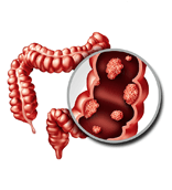 colon and rectal surgeon broward county, dr astha bhatt