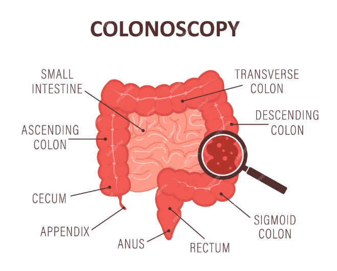 Colonoscopy in Fort Lauderdale, FL, Pompano Beach, FL, Deerfield Beach, FL, Wilton Manor, FL, Oakland Park, FL, Davie, FL, Plantation, FL, Coral Springs, FL, Margate, FL, Coconut Creek, FL and surrounding area of Broward County, Florida