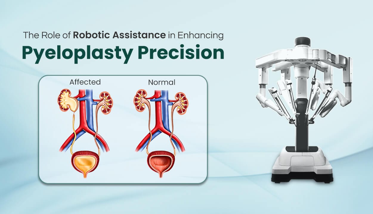 anal fistula robotic surgery pompano beach
