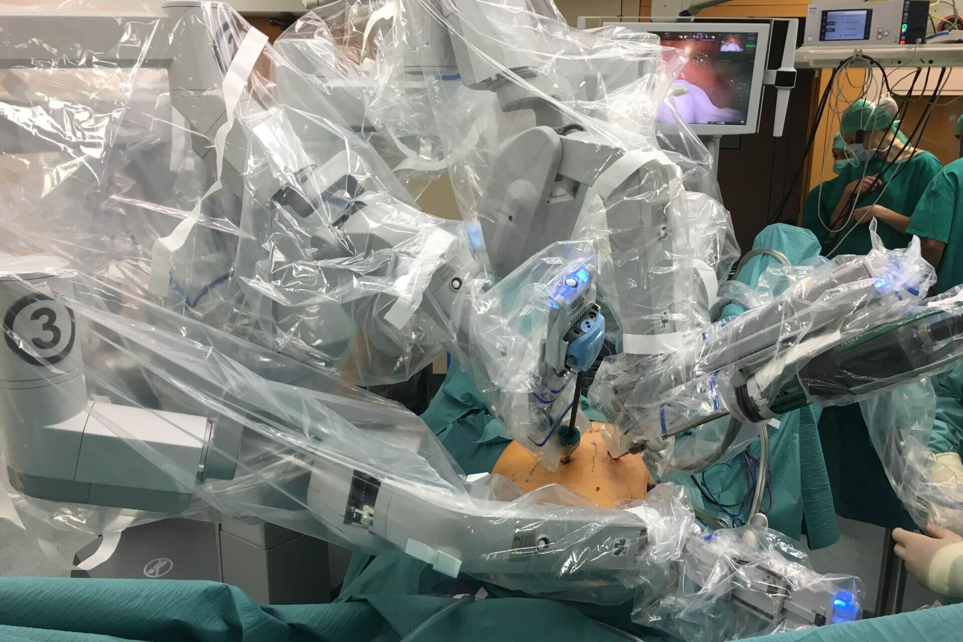 Advanced Robotic Diverticulitis Surgery