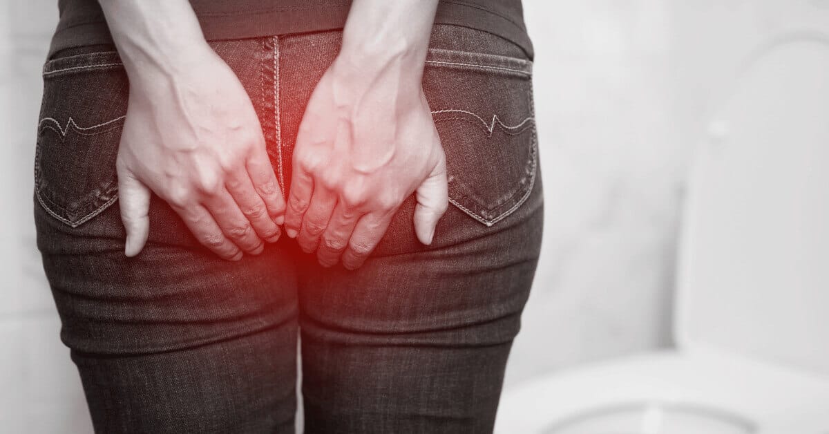 Hemorrhoids: Symptoms, Causes & Treatment