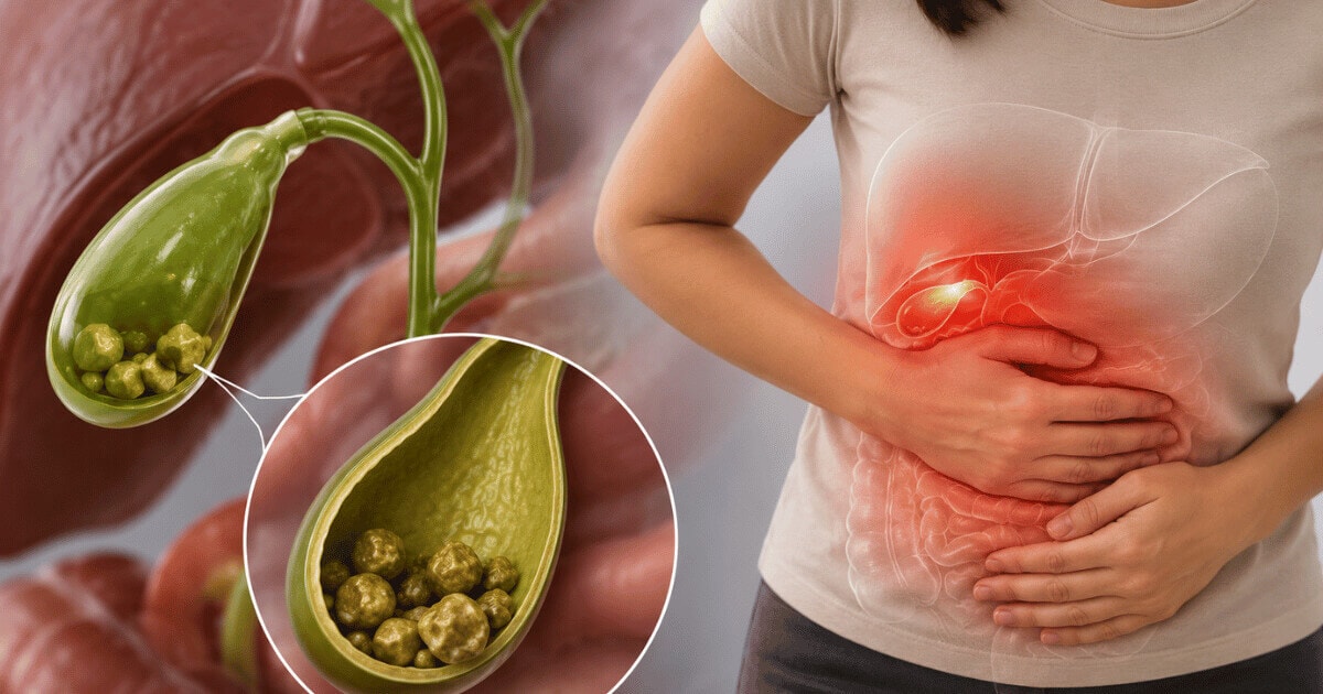 Gallbladder Disease: Symptoms, Treatment & What it is